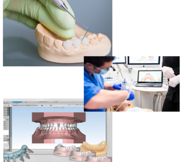 ایمپرشن دیجیتال در دنیای دنچر