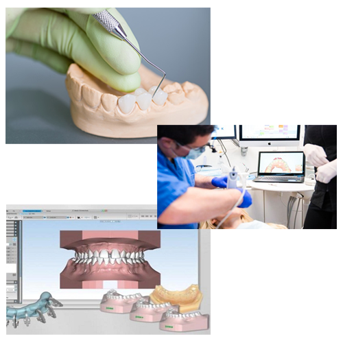 ایمپرشن دیجیتال در دنیای دنچر