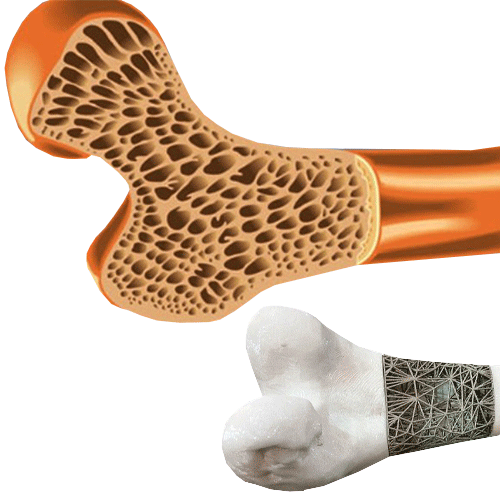 ساخت داربست های نانو کامپوزیتی