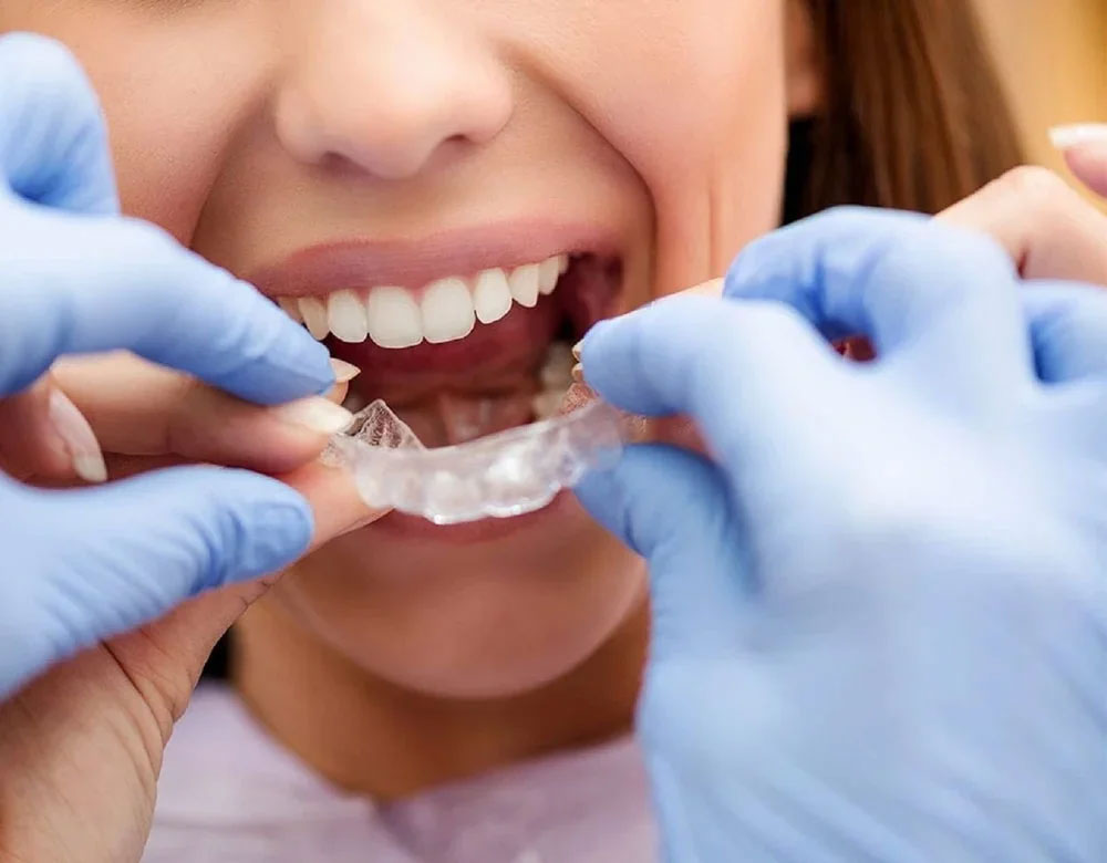 پرینتر سه بعدی دندان‌پزشکی چیست؟
